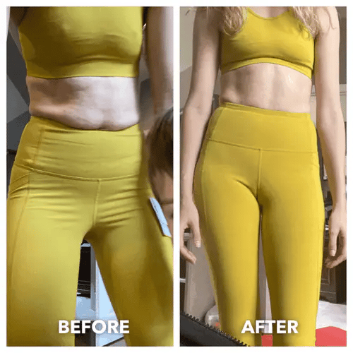 EarthEase™ Cellulite Massage Oil