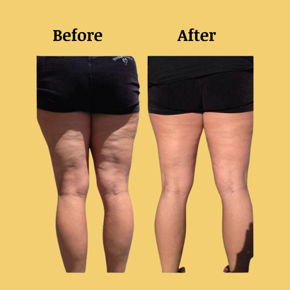 EarthEase™ Cellulite Massage Oil